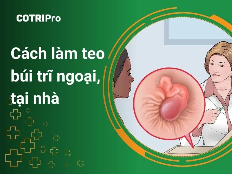 9 Cách làm co búi trĩ ngoại tại nhà an toàn, teo xẹp búi trĩ nhanh